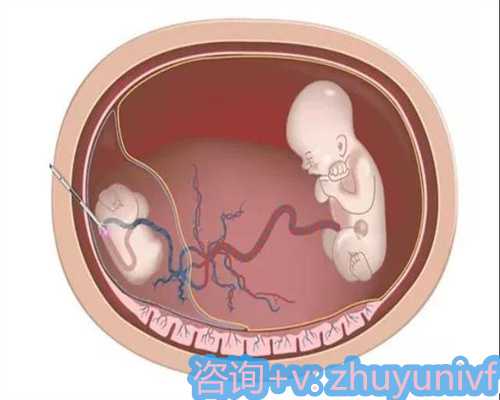 大连哪家生殖院有供卵的 如何提高精子质量