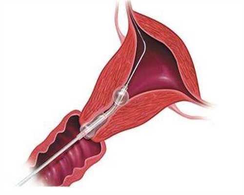 大连三代试管代孕医生，水一直放在温奶器里好吗