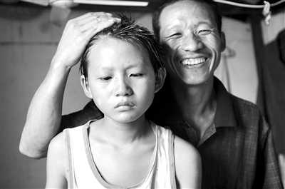 大连做供卵试管多少钱-利于百日咳恢复的饮食有哪些